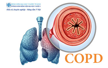 [Medscape] Screening patients with chronic obstructive pulmonary ...