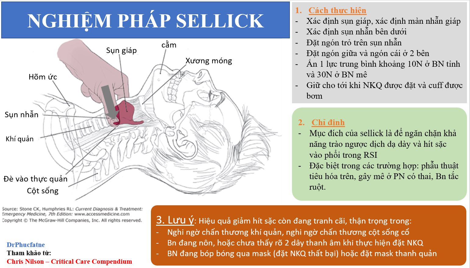 Thủ Thuật Sellick: Phương Pháp Hiệu Quả Trong Gây Mê