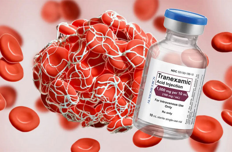Sử Dụng Axit Tranexamic (Transamin) Trong Phẫu Thuật: Tổng Quan Dựa Trên Nghiên Cứu Khoa Học tranexamic acid la thuoc gi cach dung va lieu luong cu the ra sao