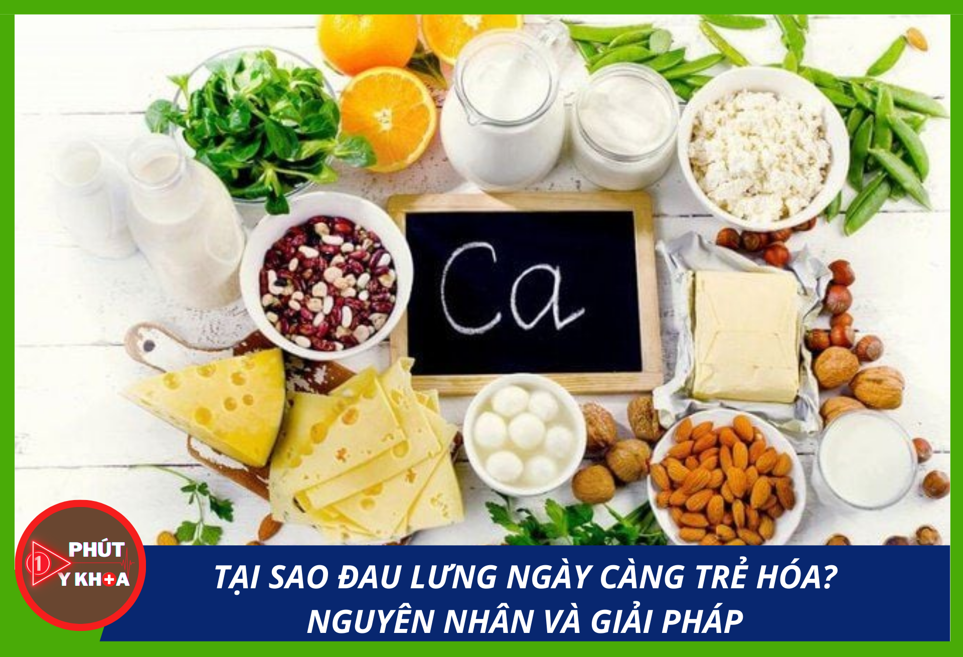 Anh bia mau 4