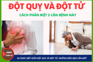 Anh bia mau 1