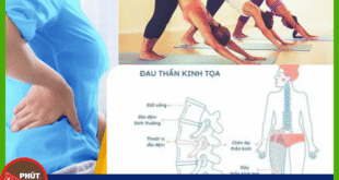 Anh bia mau 1
