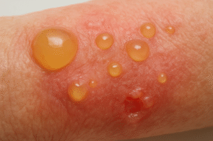 a4430379 93cd 4e7d a9cb 14d8ad586dbe