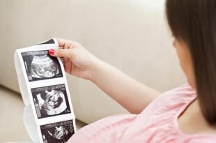 crl trong sieu am thai la gi 5