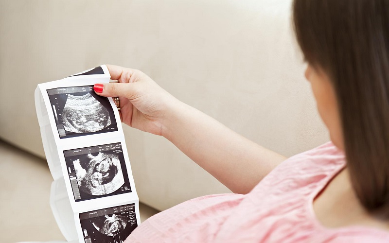 crl trong sieu am thai la gi 5