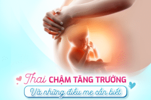 91f4da16969357d41c7e31e573d35af3