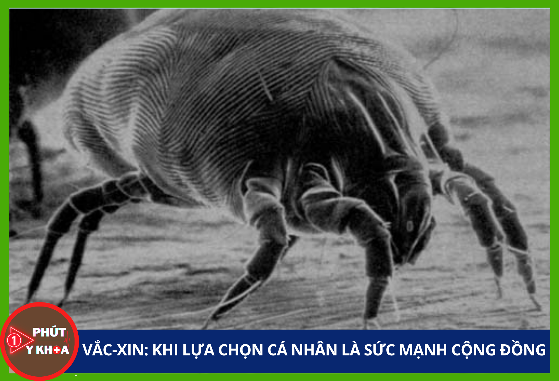 Cảnh báo: Những nguồn gây dị ứng trong nhà bạn có thể đang bỏ qua Anh bia mau