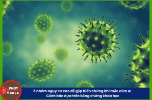 Ban sao cua Anh bia mau 12