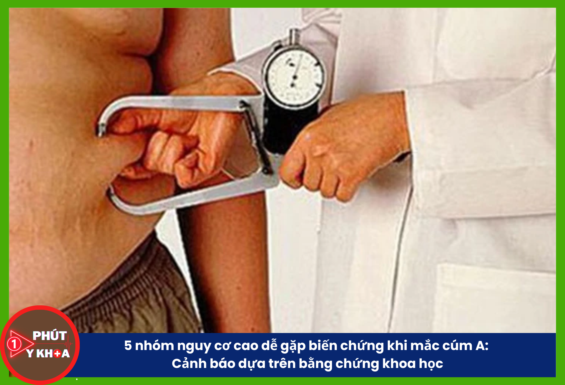 5 nhóm nguy cơ cao dễ gặp biến chứng khi mắc cúm A: Cảnh báo dựa trên bằng chứng khoa học người béo phì có nguy cơ nhập viện cao gấp 2 lần và nguy cơ tử vong cao hơn 1,5 lần khi mắc cúm