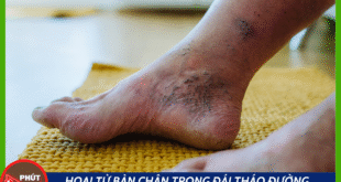 Ban sao cua Anh bia mau 9