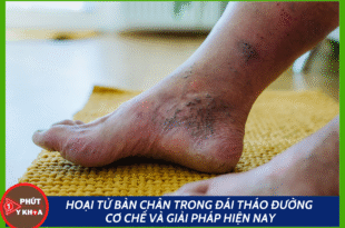 Ban sao cua Anh bia mau 9