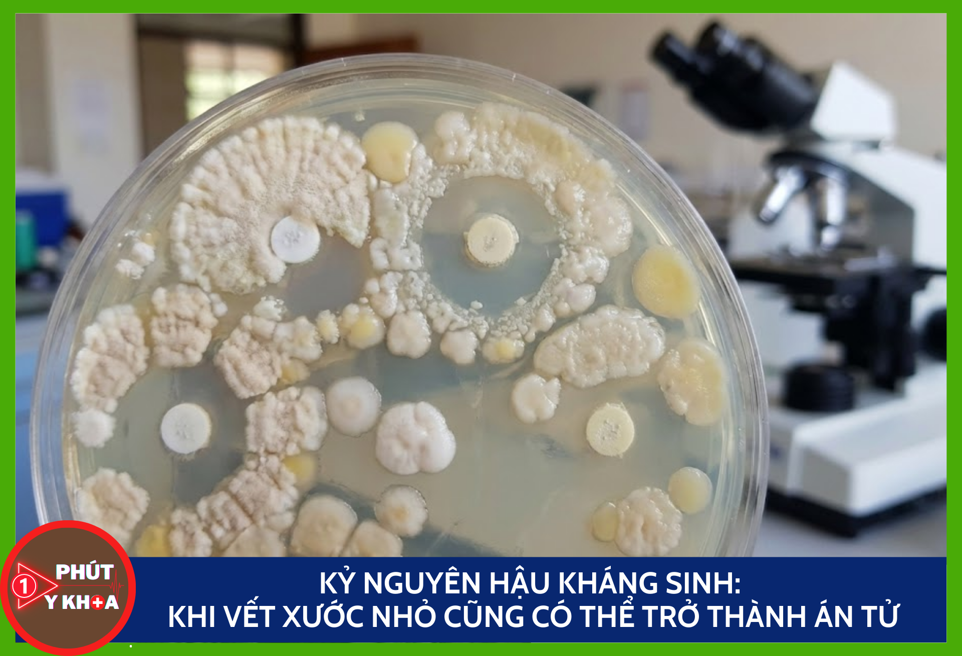 Kỷ nguyên hậu kháng sinh: Khi vết xước nhỏ cũng có thể trở thành án tử Anh bia mau 1