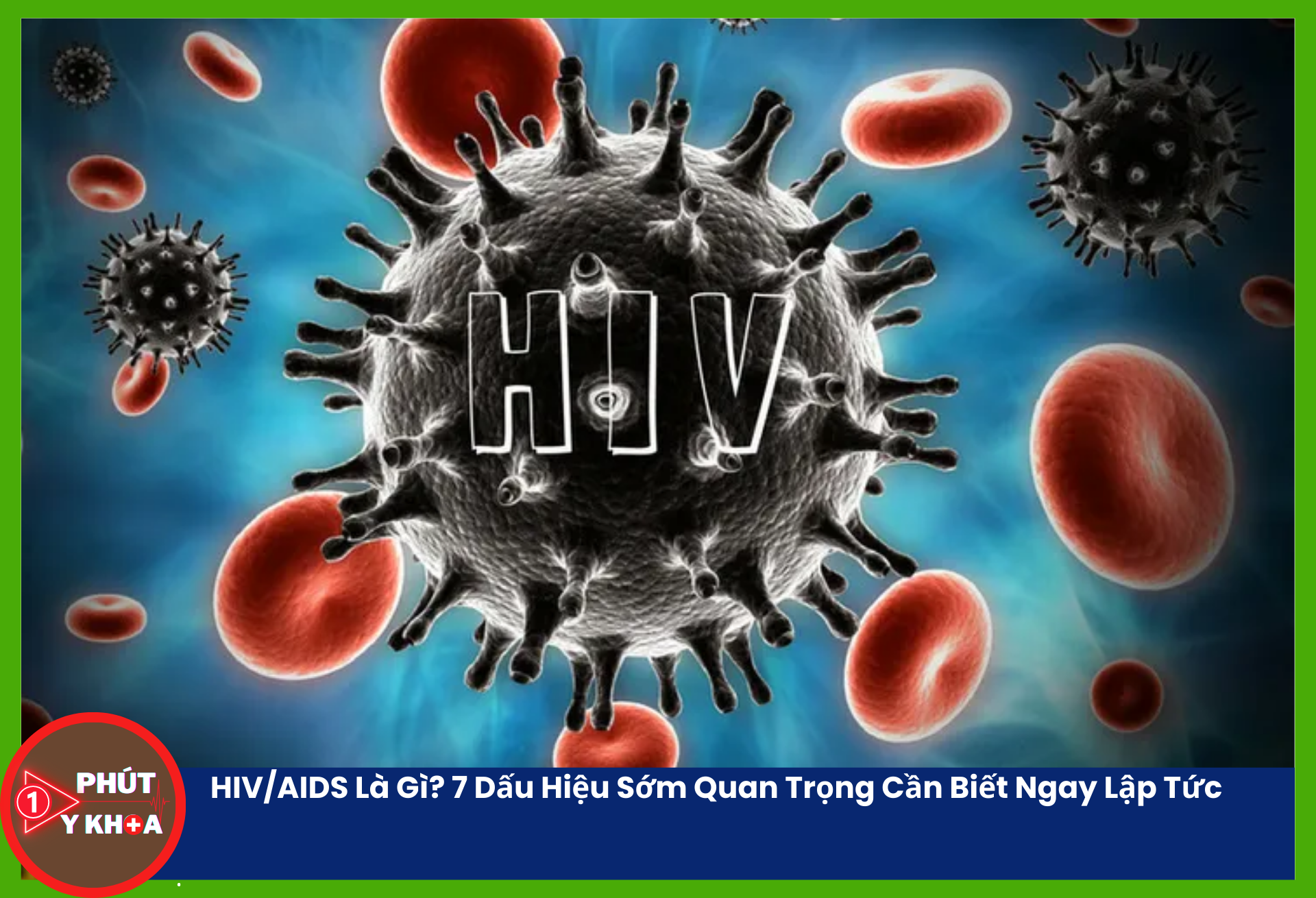 HIV - Thủ phạm gây suy giảm miễn dịch ở người