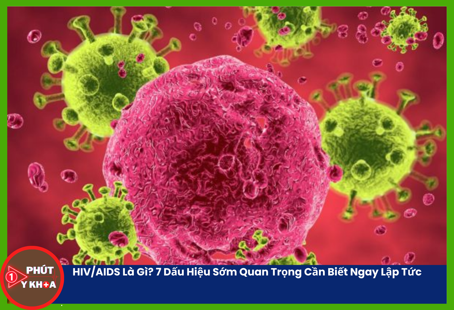 AIDS là giai đoạn muộn và nặng nhất của nhiễm HIV.