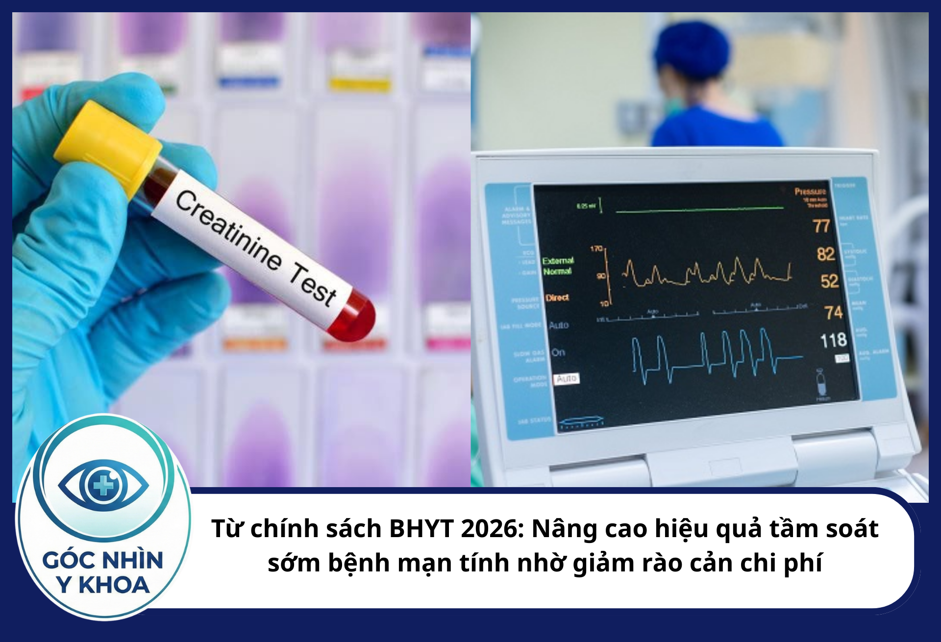 Từ chính sách BHYT 2026: Nâng cao hiệu quả tầm soát sớm bệnh mạn tính nhờ giảm rào cản chi phí Chính sách BHYT 2026 khuyến khích quản lý THA tại tuyến xã/phường. Việc cấp thuốc huyết áp định kỳ và kiểm tra các chỉ số sinh hóa (creatinin, điện tâm đồ) giúp ngăn ngừa biến chứng nhồi máu cơ tim và đột quỵ cấp tính