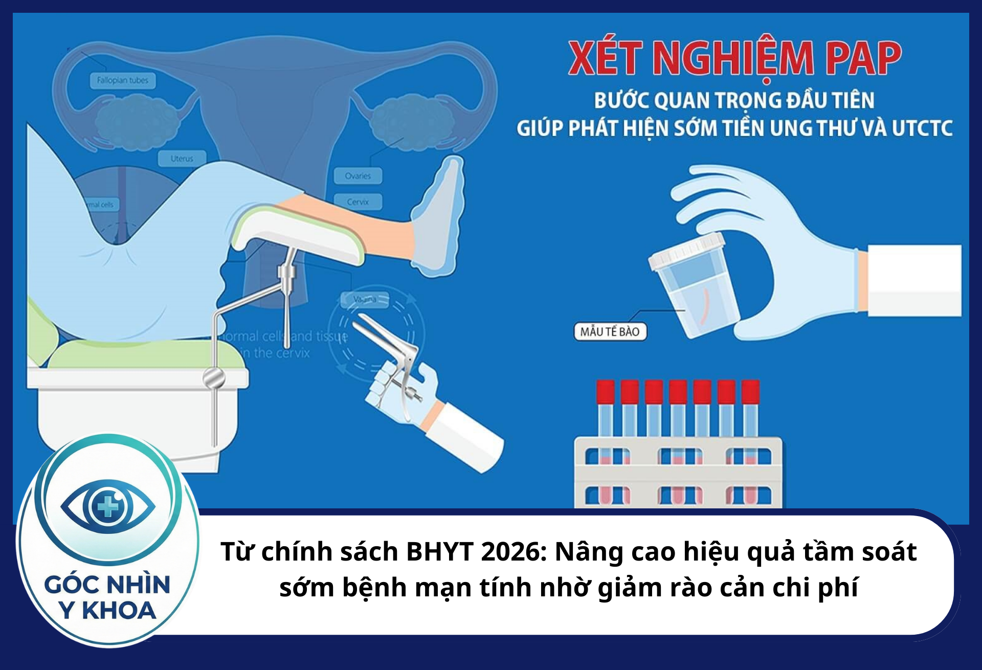 Từ chính sách BHYT 2026: Nâng cao hiệu quả tầm soát sớm bệnh mạn tính nhờ giảm rào cản chi phí Việc thanh toán BHYT cho các xét nghiệm sàng lọc tế bào học (Pap smear) và xét nghiệm HPV giúp phát hiện các tổn thương tiền ung thư (CIN 1, 2, 3)