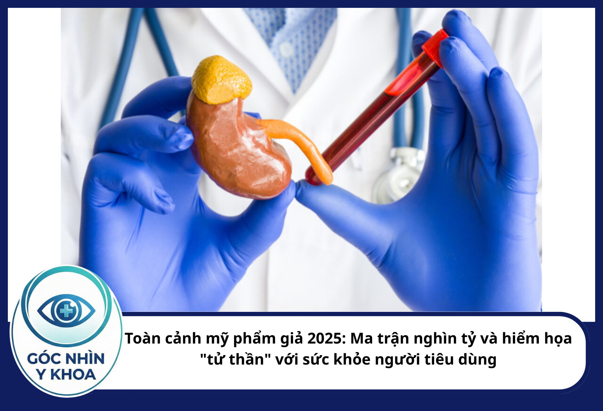 Corticoid có thể thẩm thấu qua da vào hệ tuần hoàn, gây ức chế trục hạ đồi - tuyến yên - tuyến thượng thận (HPA), dẫn đến suy thượng thận cấp