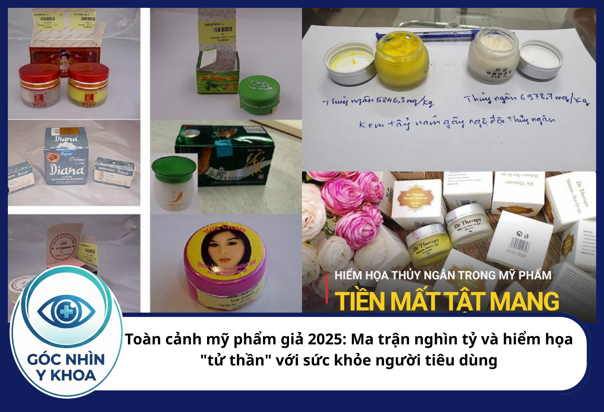Thủy ngân thường được sử dụng trong mỹ phẩm giả với tác dụng làm trắng, việc sử dụng lâu dài có thể gây ra những hệ lụy khôn lường tới sức khỏe.