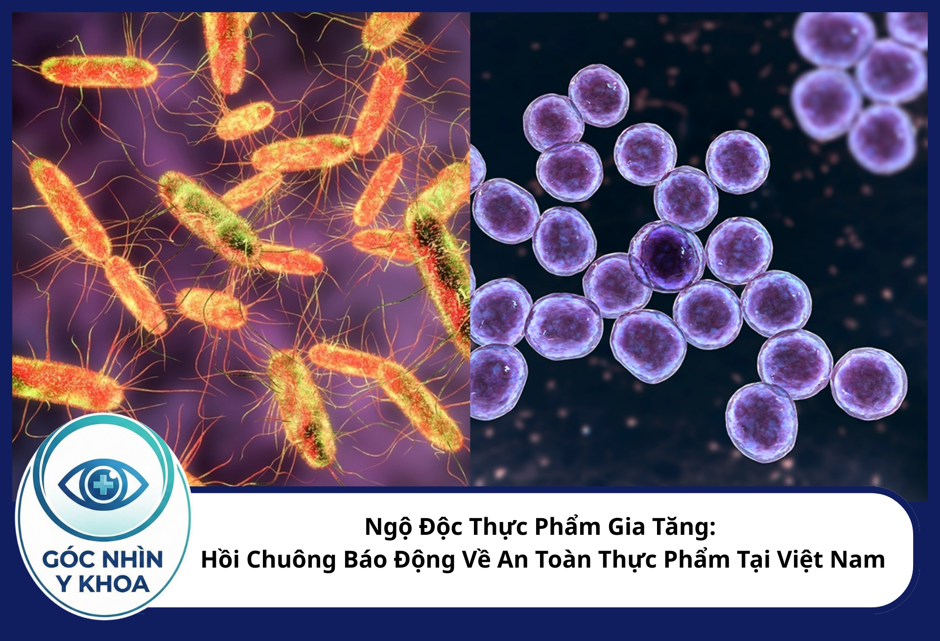 Salmonella (bên trái) và Tụ cầu vàng (bên phải) thường là nguyên nhân chính gây ngộ độc