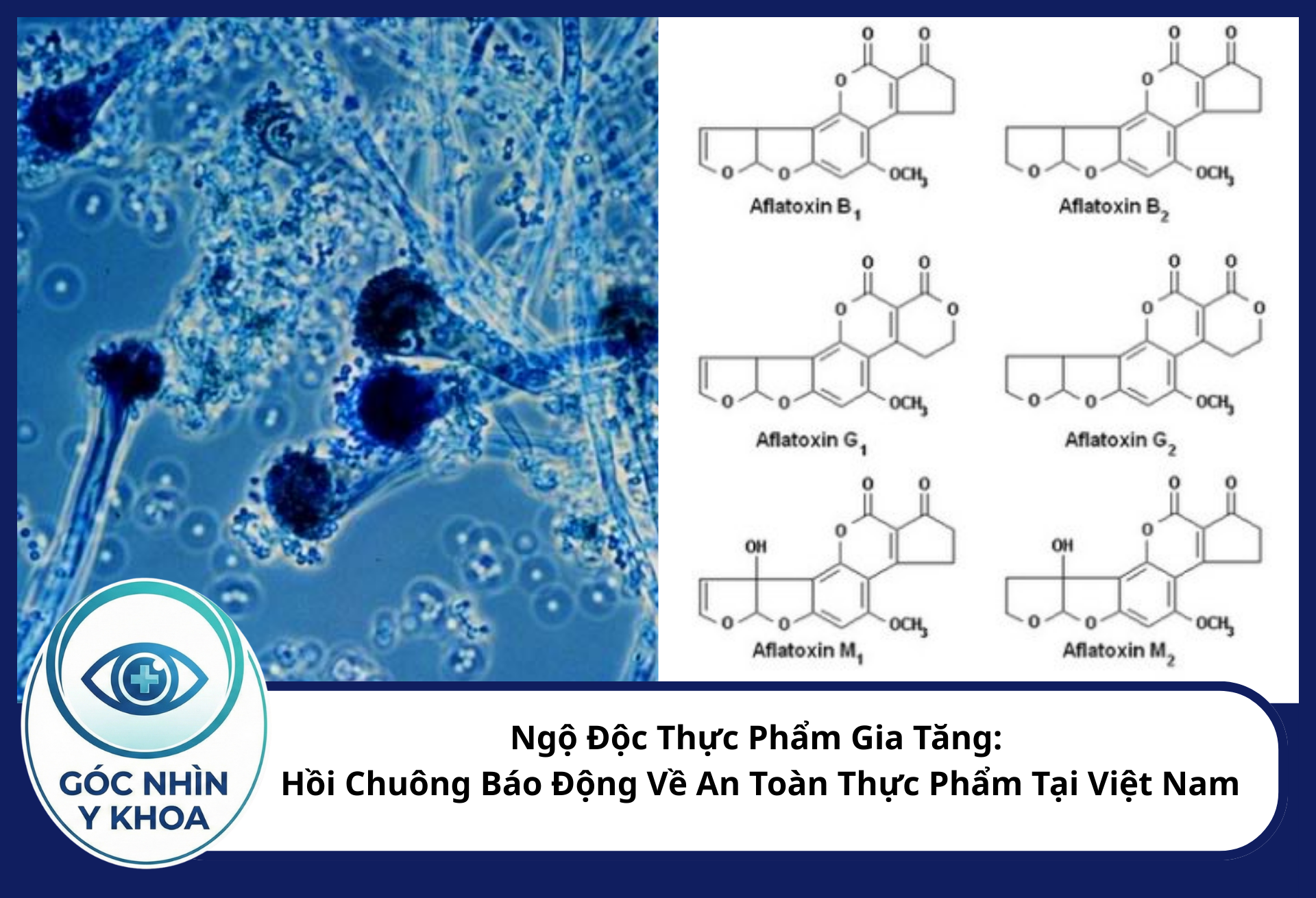 Nấm mốc Aspergillus (bên trái) khi sinh trưởng sẽ tiết ra Aflatoxin (bên phải) - một loại độc tố có nguy cơ gây ung thư gan