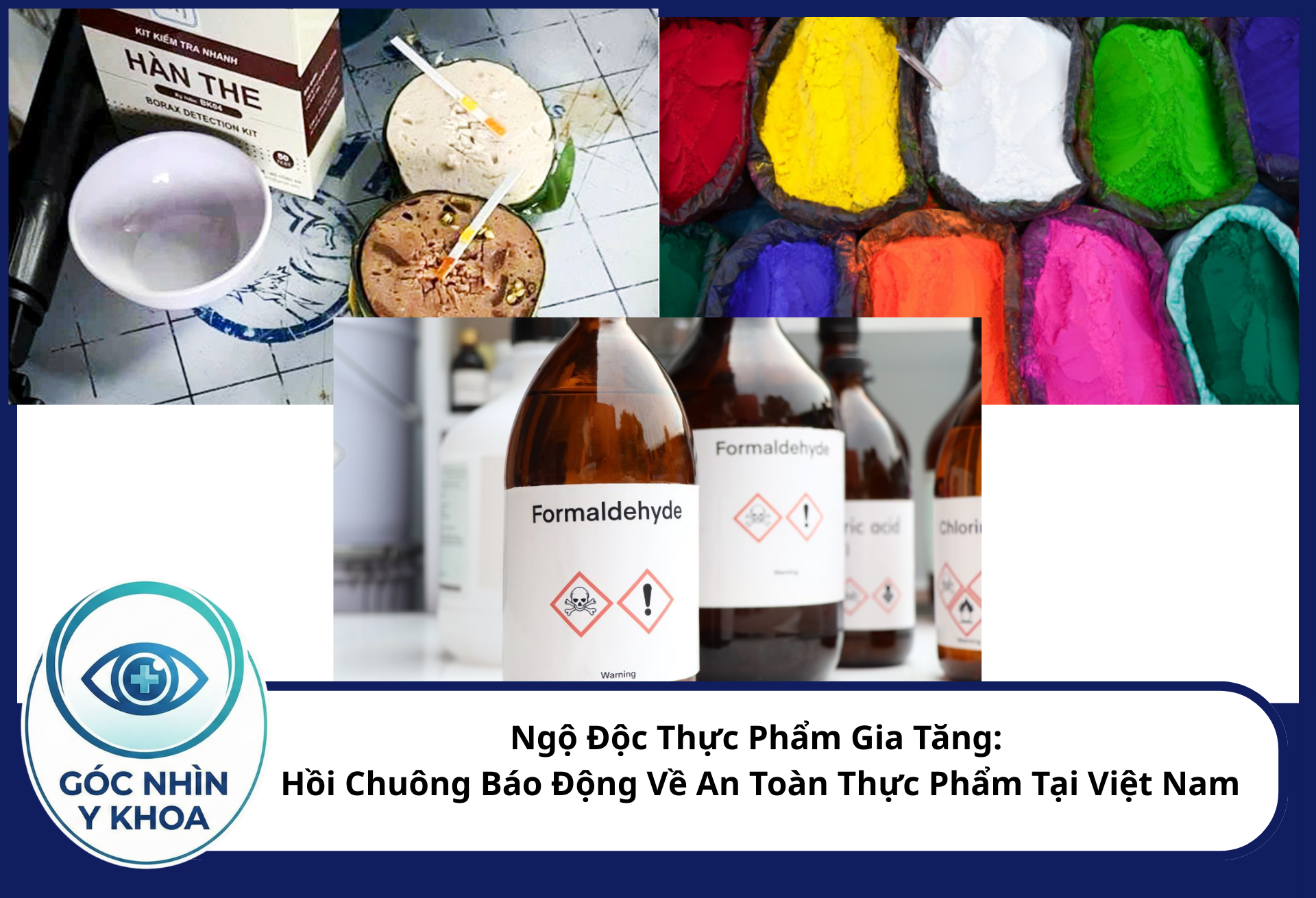 Hàn the, phẩm màu công nghiệp cũng như chất bảo quản trong thực phẩm gây hại lớn tới sức khỏe con người