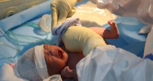 ky thuat hoi suc so sinh ngat Bluecare