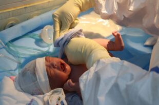 ky thuat hoi suc so sinh ngat Bluecare