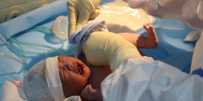 ky thuat hoi suc so sinh ngat Bluecare