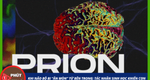 prion nxd 2