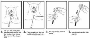 xet nghiem GBS la gi 3