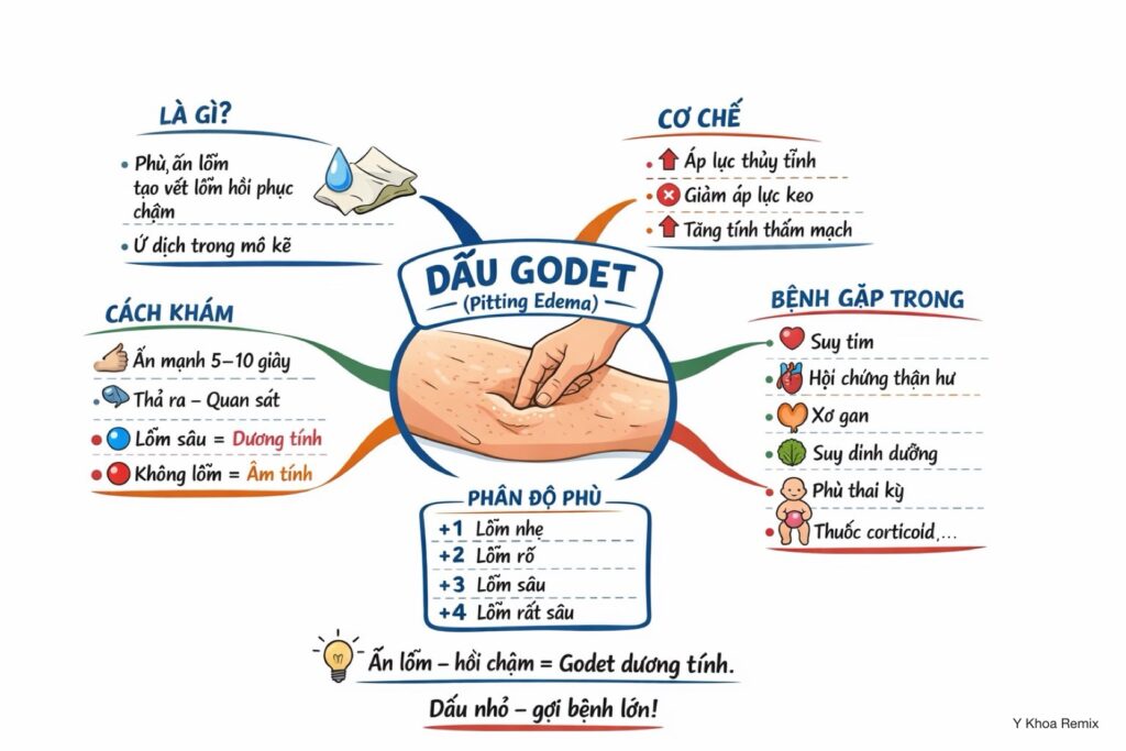 DẤU GODET- NHẬN BIẾT TÌNH TRẠNG PHÙ TRONG CƠ THỂ 1.30 dau godet 1 1