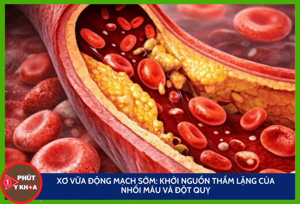 Anh bia mau cua minh