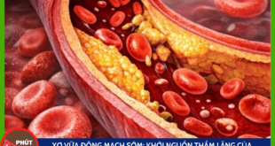 Anh bia mau cua minh