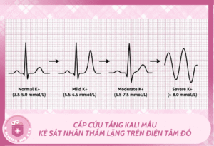 Ban sao cua Mchau 38