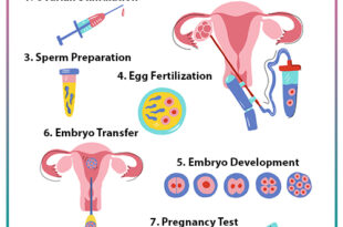 Common Questions About IVF