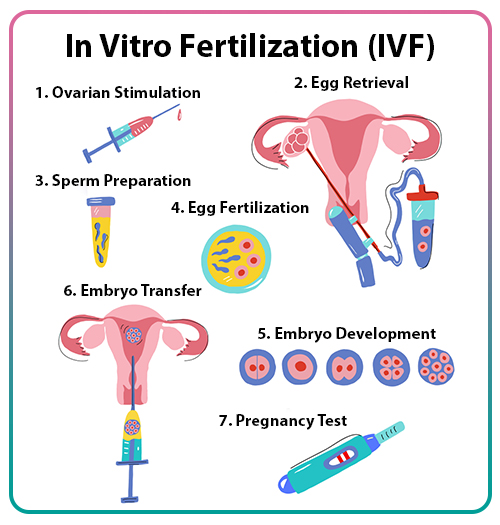 Common Questions About IVF
