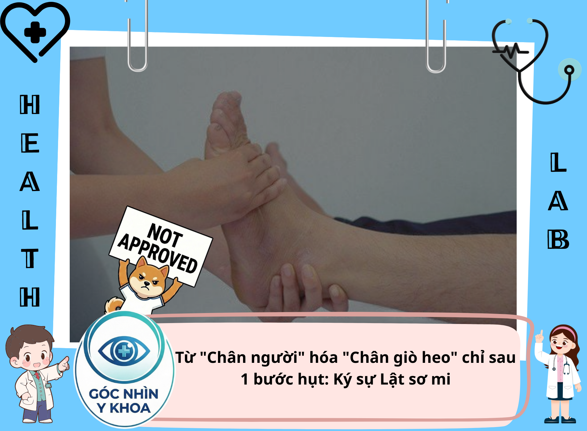 Lật sơ mi mà thằng bạn kêu bẻ khớp cho bạn thì hãy đồng ý=))). Và bạn sẽ được nghỉ ngơi nhiều hơn...