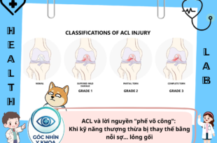 ACL và lời nguyền "phế võ công": Khi kỹ năng thượng thừa bị thay thế bằng nỗi sợ… lỏng gối