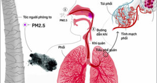 bui pm 2 5 gay o nhiem khong khi la gi tac hai va cach phong tranh bui 2 5 27