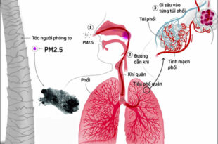 bui pm 2 5 gay o nhiem khong khi la gi tac hai va cach phong tranh bui 2 5 27