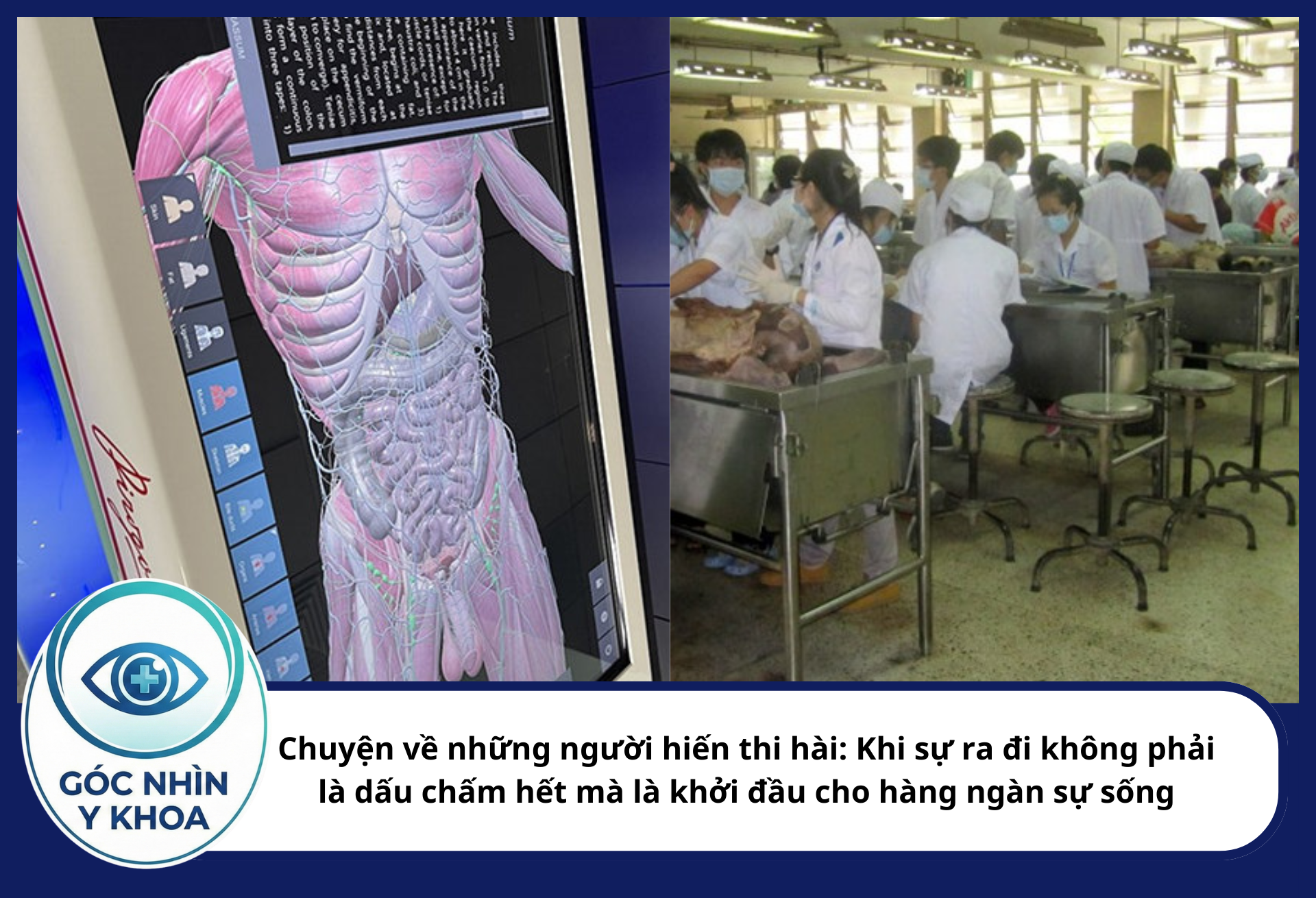 Chuyện về những người hiến thi hài: Khi sự ra đi không phải là dấu chấm hết mà là khởi đầu cho hàng ngàn sự sống Mỗi người là một cá thể khác biệt, không ai giống ai, nên cấu trúc rất khác nhau, so với mô hình số thì mô hình số đơn giản chỉ là 1 cấu tạo hoàn hảo nhưng không thực tế.