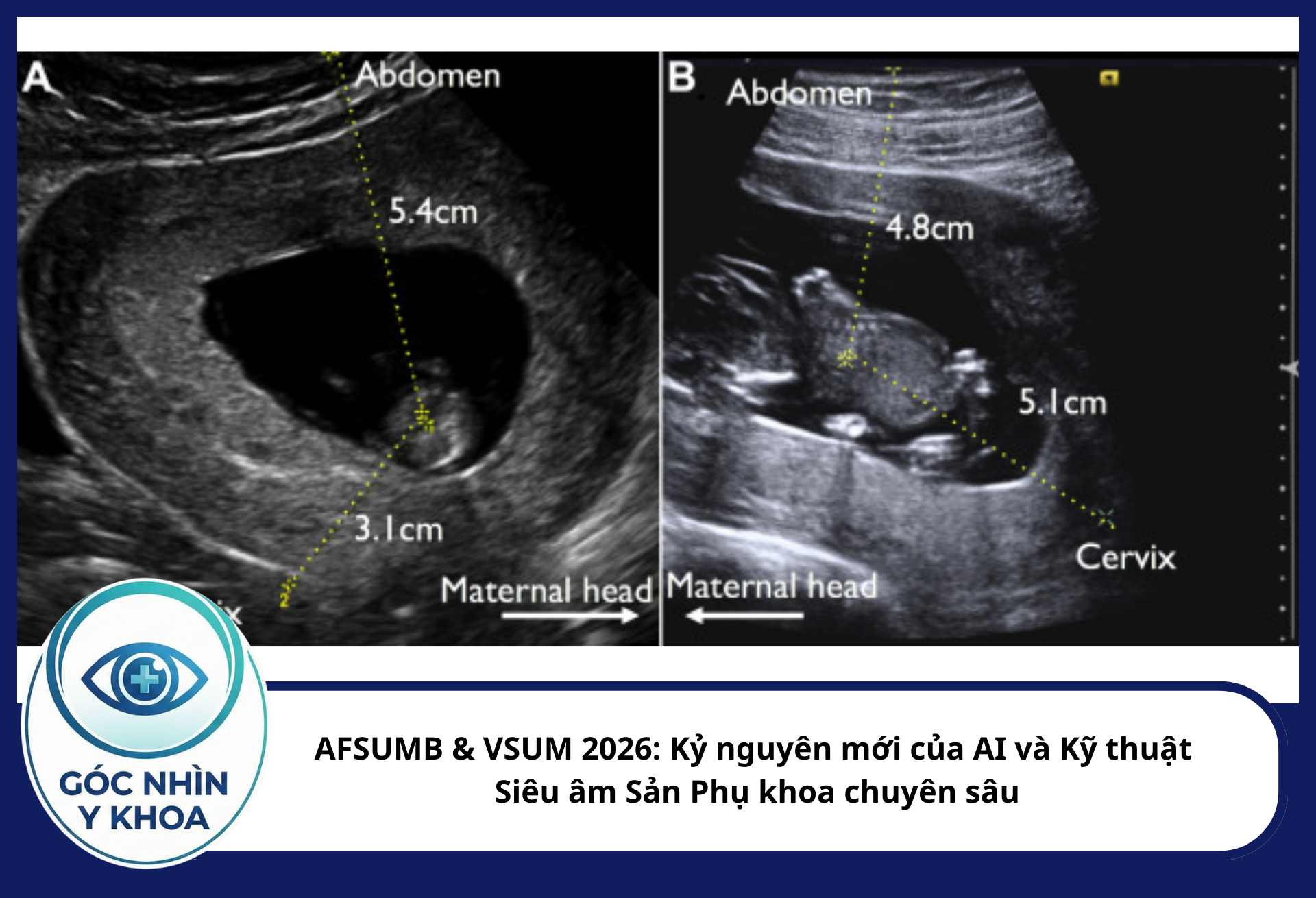 Với sự hỗ trợ của các đầu dò tần số cao và công nghệ xử lý hình ảnh mới, việc chẩn đoán các bệnh lý tim bẩm sinh phức tạp có thể được thực hiện sớm hơn nhiều so với mốc 22 tuần truyền thống.