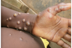 photo 1755323207529 17553232077132131405365