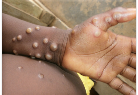 photo 1755323207529 17553232077132131405365