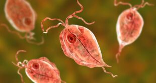 20191225 145516 666649 trichomonas max 1800x1800 jpg 48a20254be