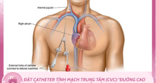 MLYK Y khoa bo tui 11