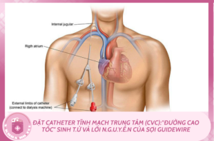 MLYK Y khoa bo tui 11