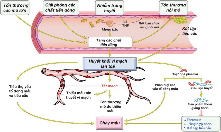 nh của đông máu nội mạch lan tỏa (DIC)
