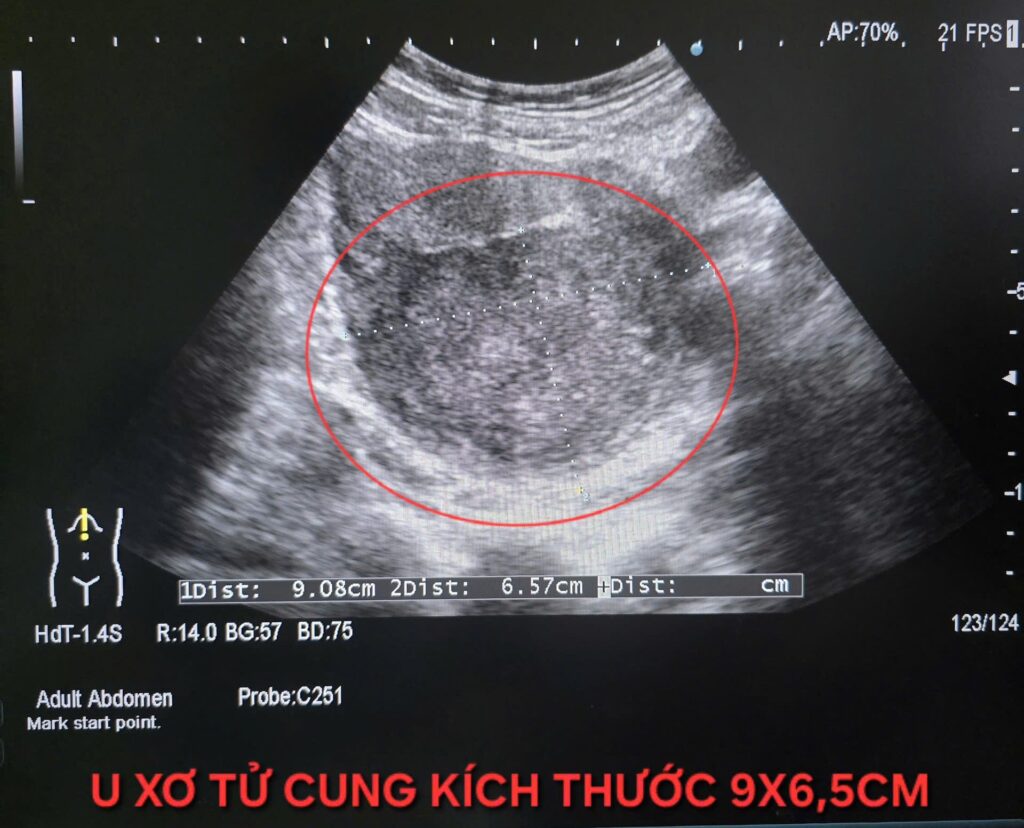 ba5dd82f 9028 4fcd 8946 1ea6b5676e1d e1761296789582