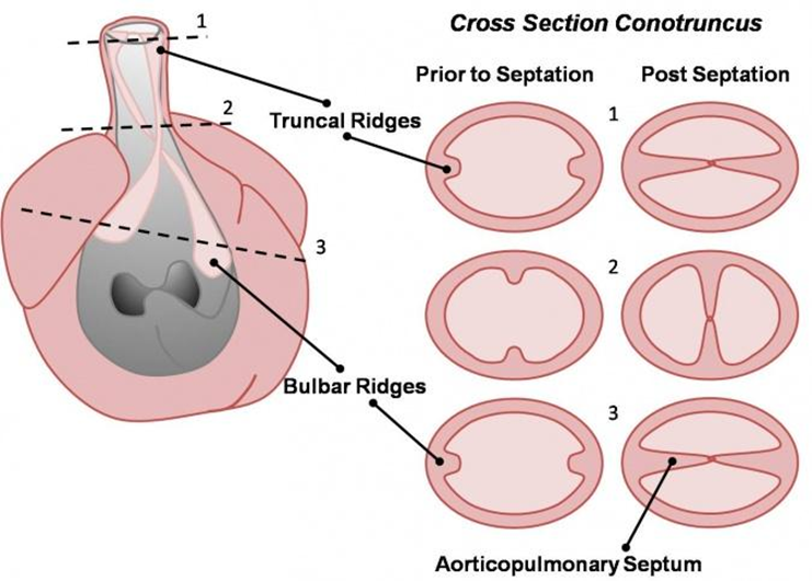 Hình minh họa sự hình thành vách nón–thân (aorticopulmonary septum) trong phát triển phôi tim.